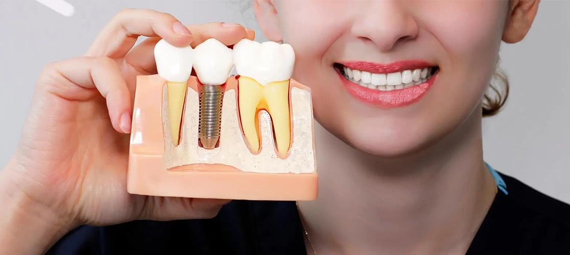 Get pain-free dental implant treatment near Anandvalli, Nashik, with expert care from our dentist.