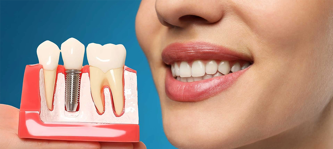 Expert implantologist in Nashik offering safe and lasting solutions for dental implants.