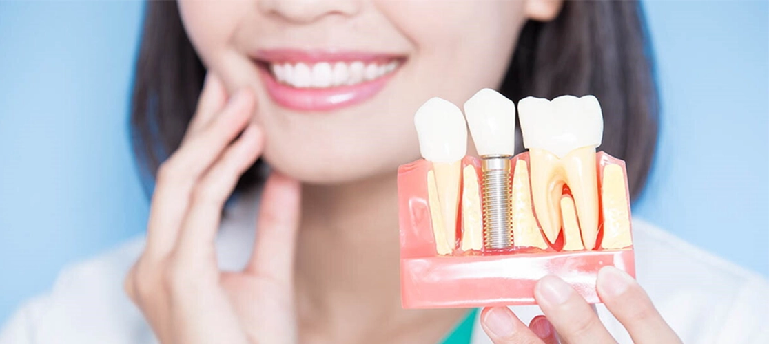 Best dental implant specialists in Panchavati with expert care for natural-looking, durable false teeth.