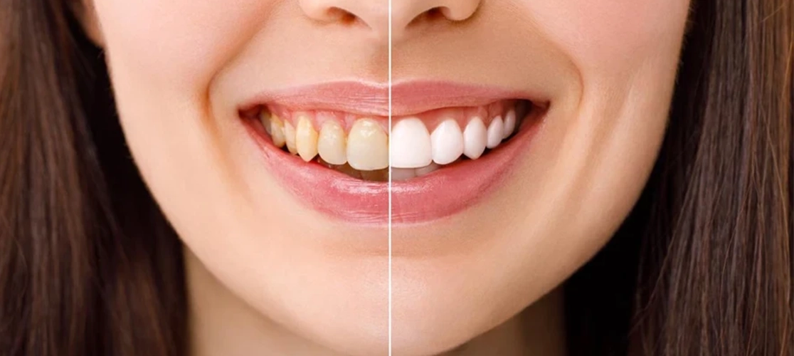 Smile Designers Dental Clinic & Orthodontic Care in Panchavati for expert dental treatments